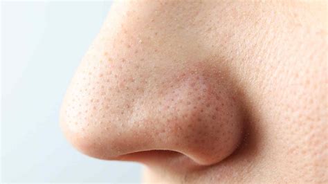 nose puns     sniffle