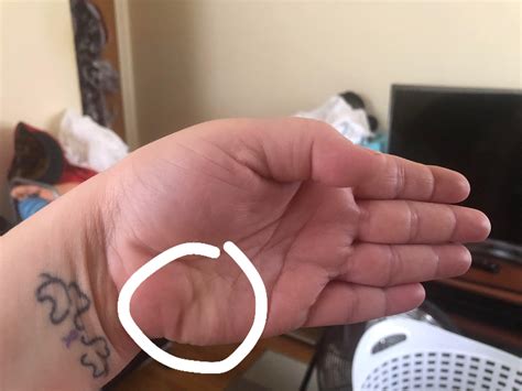 Muscle health improves once you solve why is my thumb twitching on right hand 3