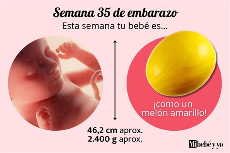 Bebe A Las 35 Semanas - Ecografía Del Feto De 35 Semanas Visualización Y Validación Del