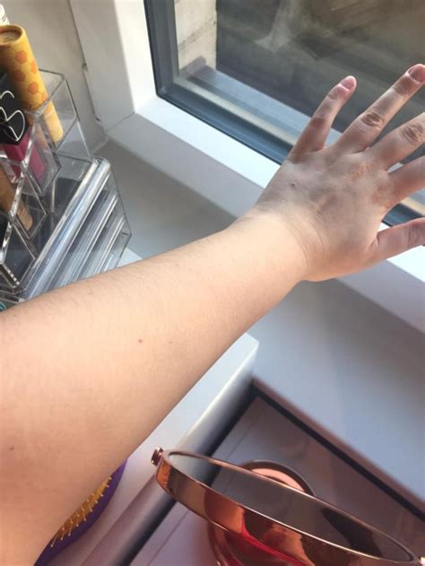 Is the new St Moriz colour correcting fake tan worth the faff? | Metro News