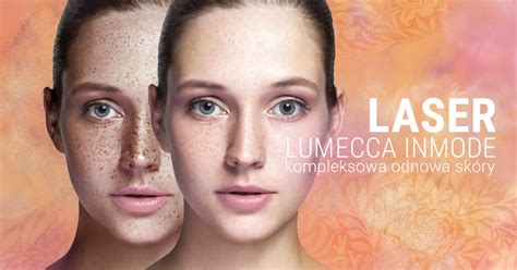 Фотоомоложение Lumecca Отзывы — Фото Картинки