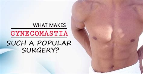 gynecomastia   popular surgery dailyscrawl