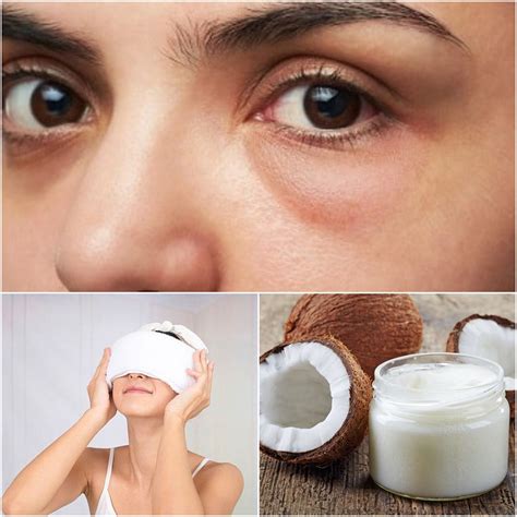 Effective Solutions for Reducing Puffy Eyes: Top Tips and Remedies - Hunter Games Magazine