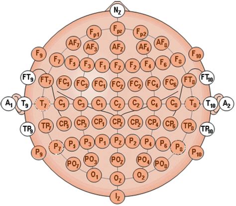 distribution  electrodes   international  positioning