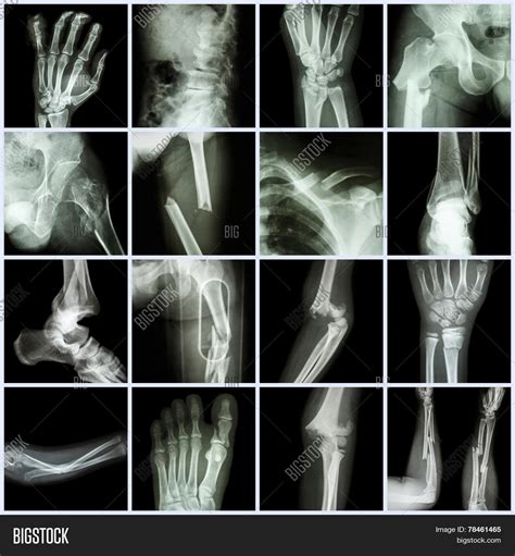 Collection X-ray Image & Photo (Free Trial) | Bigstock