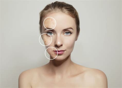 congested skin skinspaceuk