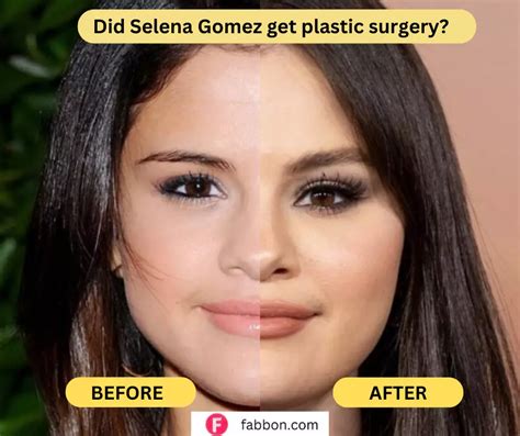 Did Selena Gomez Get Plastic Surgery ? | Fabbon