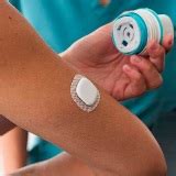 Medtronic Simplera Sync