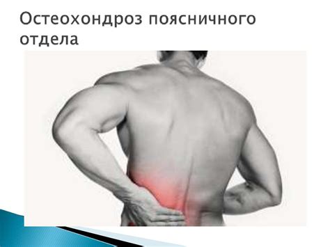 Остеохондроз поясничного отдела - презентация онлайн