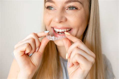 invisalign cost  uk pricing guide