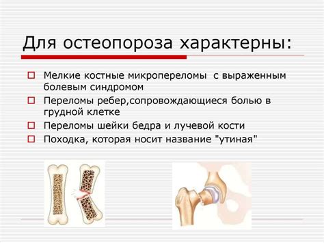 «Безмолвная эпидемия». Остеопороз - презентация онлайн