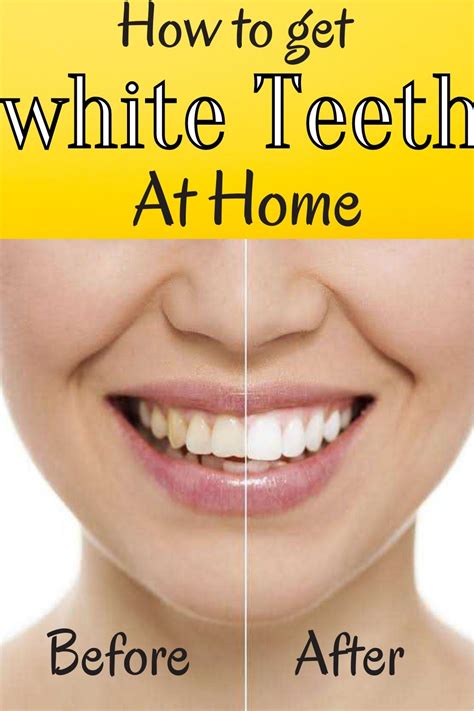 how to achieve white teeth at home