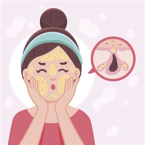 cara mengatasi komedo di hidung 18