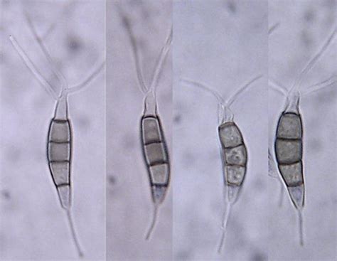 Discover the Unique Benefits of Pestalotiopsis Microspora Mushrooms for Health and Wellness - Hunter Games Magazine