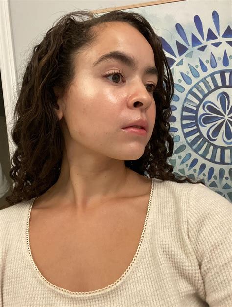 how i got rid of my Perioral dermatitis with 2 products. : r/Perioral