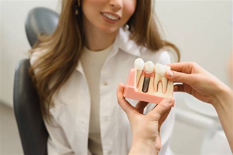 A Brief Outline of the Dental Implant Procedure Timeline - NuDental
