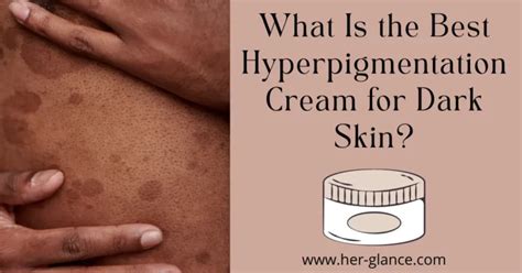 Best Hyperpigmentation Cream for Dark Skin | HerGlance