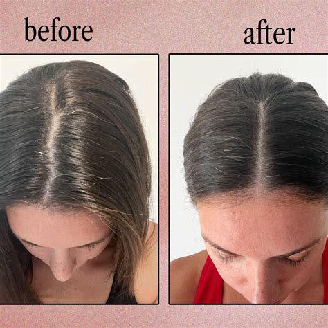 8 Best Baby Shampoos, According to Pediatric Dermatologists & Moms