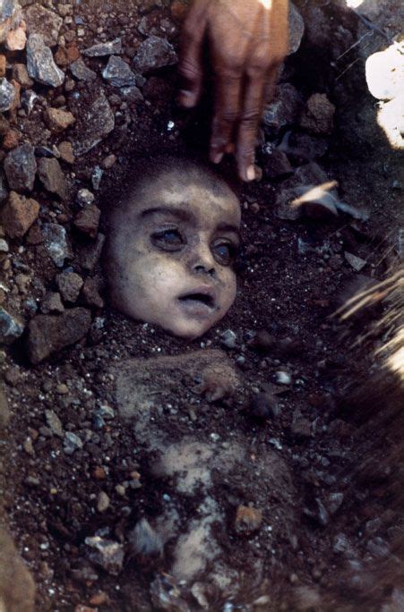 Bhopal Disaster Girl Uncovered from Rubble : creepy