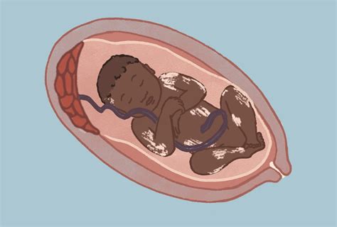 Gravid Uke 24 Vektøkning