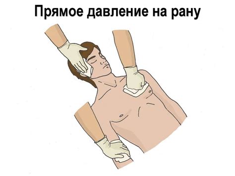 Оказание первой помощи при наружных кровотечениях и травмах ...