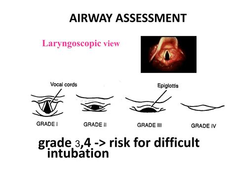 endotracheal intubation powerpoint