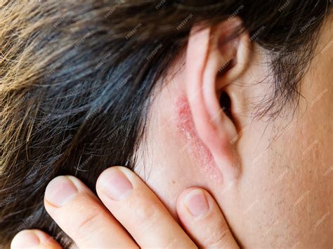 Liquido Seminale Irritazione Pelle 4