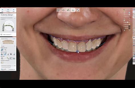 Best Cosmetic Dentistry Services Sydney - Inner West Dental