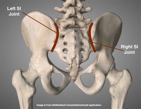 The SI Joint....from A PT Perspective | CHARM