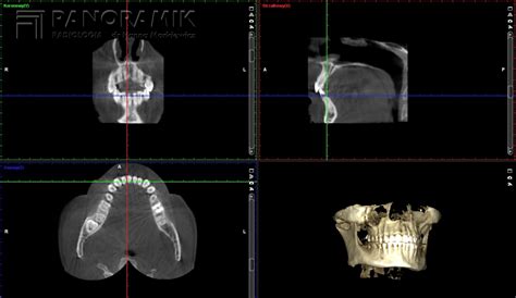 Panoramik | Strona firmy Panoramik - Radiologia cyfrowa