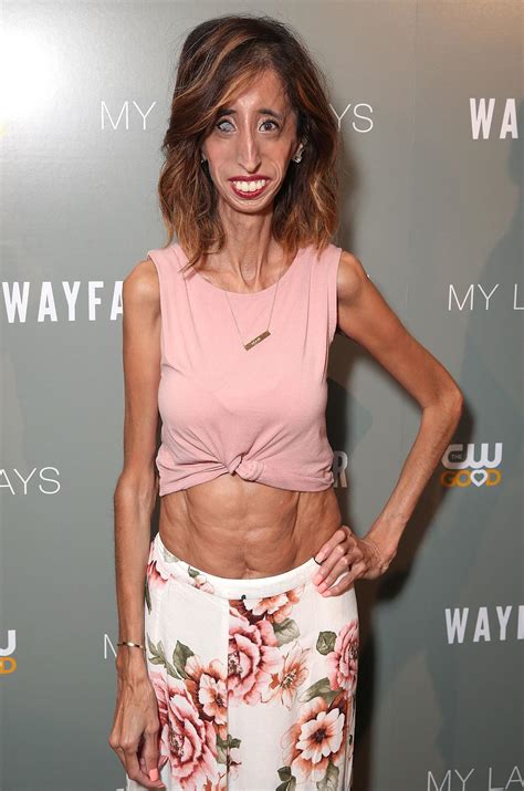 Lizzie Velasquez on Continuing to Look for Love: 'Dating Isn't as