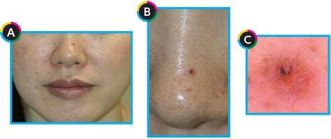 visual learning  dermatology derma times