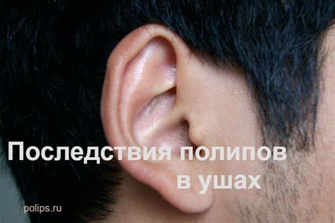 Лечение полипа в ухе: операция и народные средства