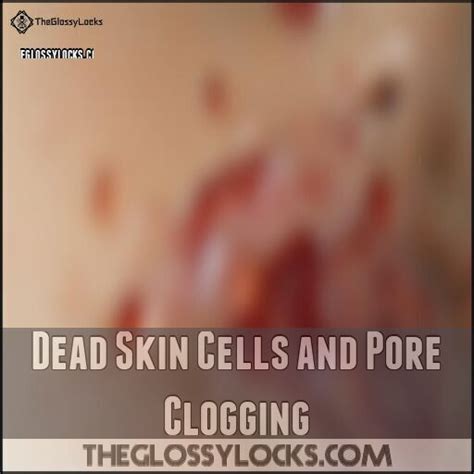 acne treatment  sensitive skin  products dermatologists love