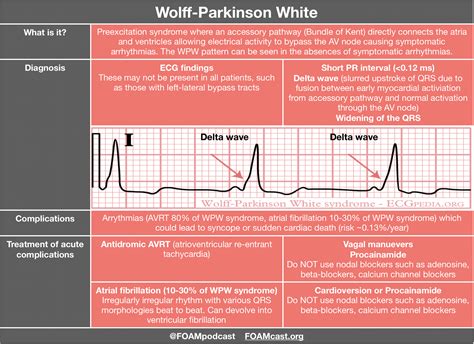What Is The Treatment Of Ventricular Fibrillation