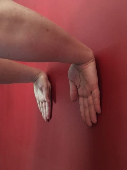 Forearm/Wrist Flexor and Extensor Self-Care and Stretches - Therapy Lounge