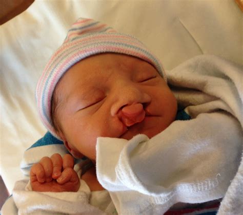 I need to go to Lowe's first... - Just Call Me Homegirl | Cleft lip ...