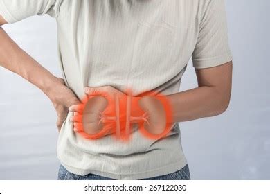 human kidney failure stock photo edit