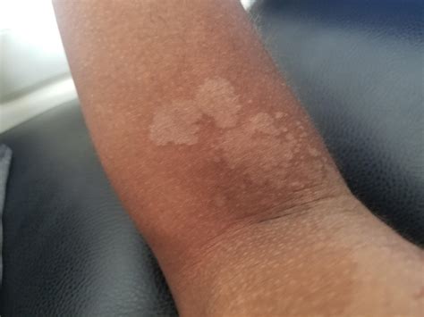 weird spots  skin  itchy  painful