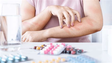 Alergia A Formol O Que Tomar - Alergia a Medicamentos: Entenda os Sintomas, Diagnóstico e Cuidados ...