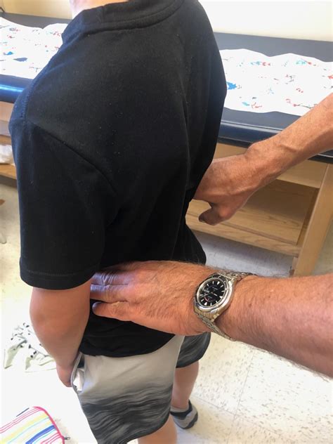 Functional Scoliosis - Leg Length Discrepancy - Limb Length Discrepancy