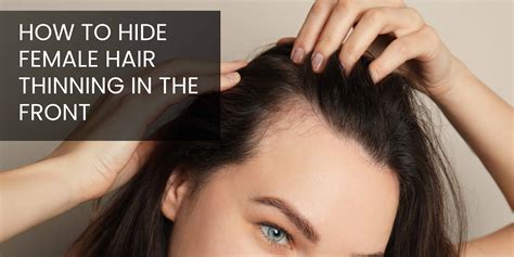 How to Hide Female Hair Thinning in the Front – SURETHIK-USA