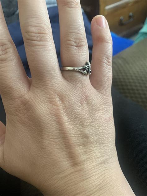 Acrogeria? I’m a 32 year old female. Do my hands look “older “? I go to ...