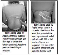 Slipping Rib Syndrome - Physiopedia