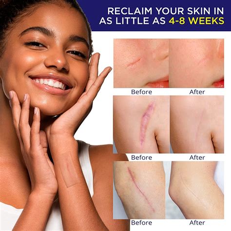 Advanced Silicone Scar Sheets Roll - Medical Grade Gel Tape for Scar