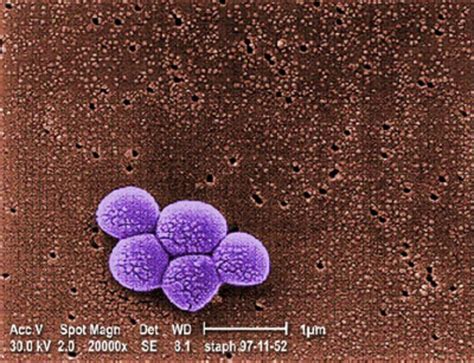 ESA - Staphylococcus aureus (MRSA) bacteria