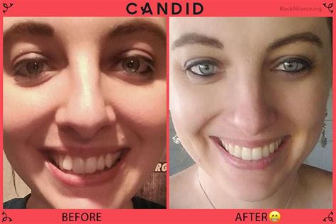 Don't Use Forum Candid Until You Read This! - 27uyw90