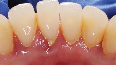 key tenets fig  decisions  dentistry