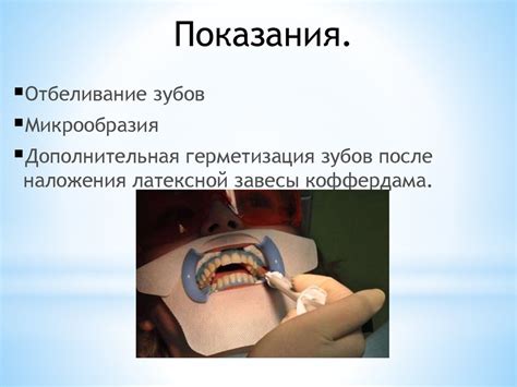 Коффердам оптидам, жидкий коффердам - презентация онлайн