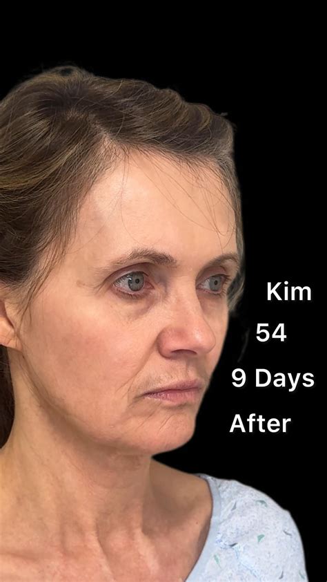 Most of my patients travel for surgery. We have this process down to a